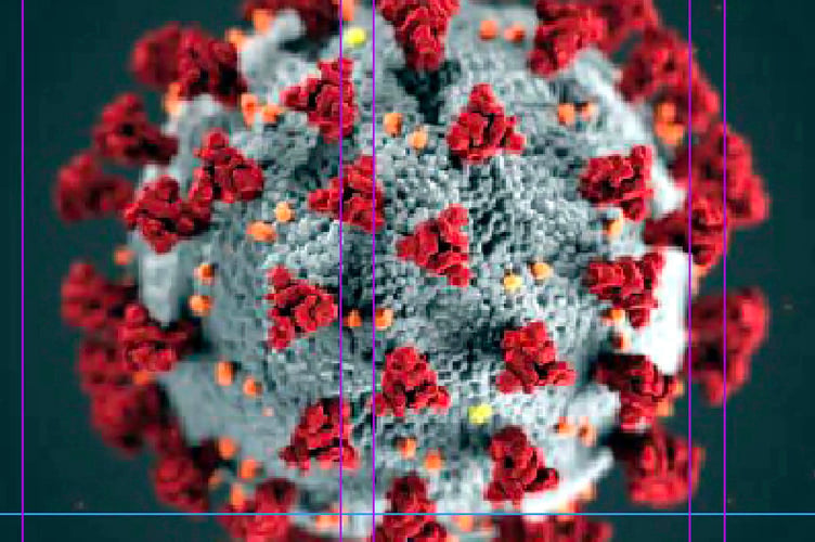 Coronavirus.