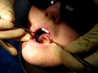 More than 100 hospital admissions in Teignbridge to remove children's rotten teeth