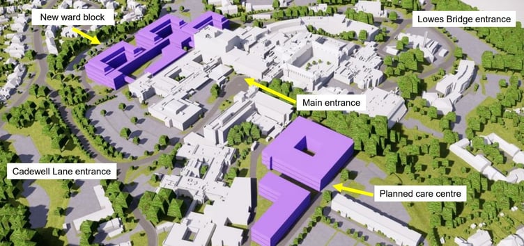 New plans for Torbay Hospital