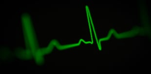 Heart attack care trial decision deferred